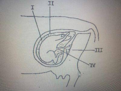 Diagram for this question