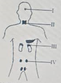 Diagram for this question