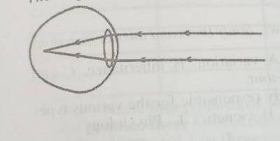 Diagram for this question