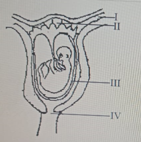 Diagram for this question