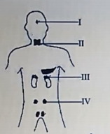 Diagram for this question