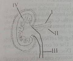 Diagram for this question